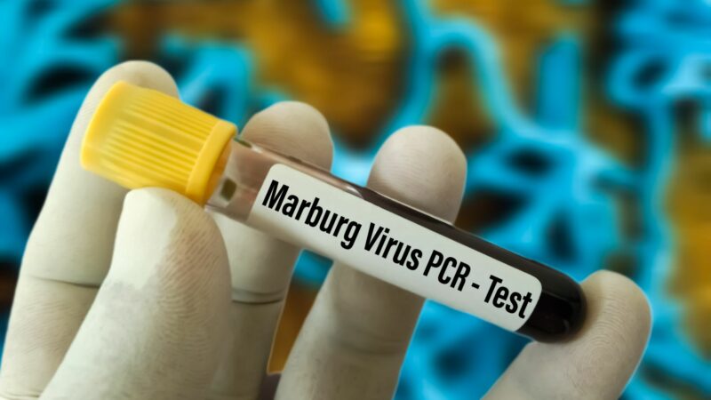 Rwanda/Campagne inédite de vaccination contre le virus de Marburg: 856 sujets déjà immunisés